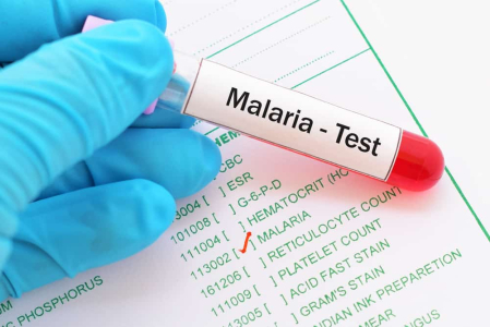Tanda dan Gejala Penyakit Malaria yang Tidak Boleh Anda Abaikan