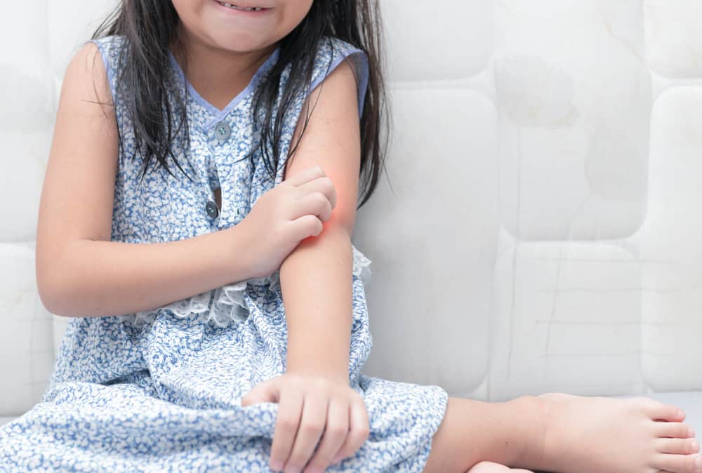 Alergi pada Anak: Ketahui Penyebab dan Jenisnya