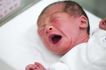 Infeksi Gonore Bisa Menyerang Mata Bayi, Apa Penyebabnya?