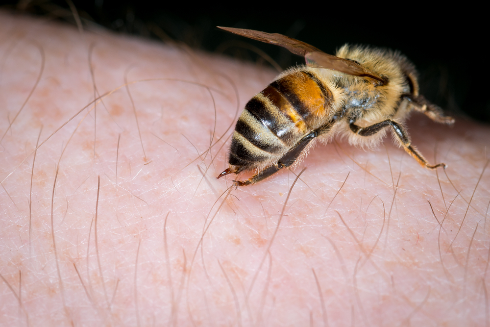 terapi sengat lebah