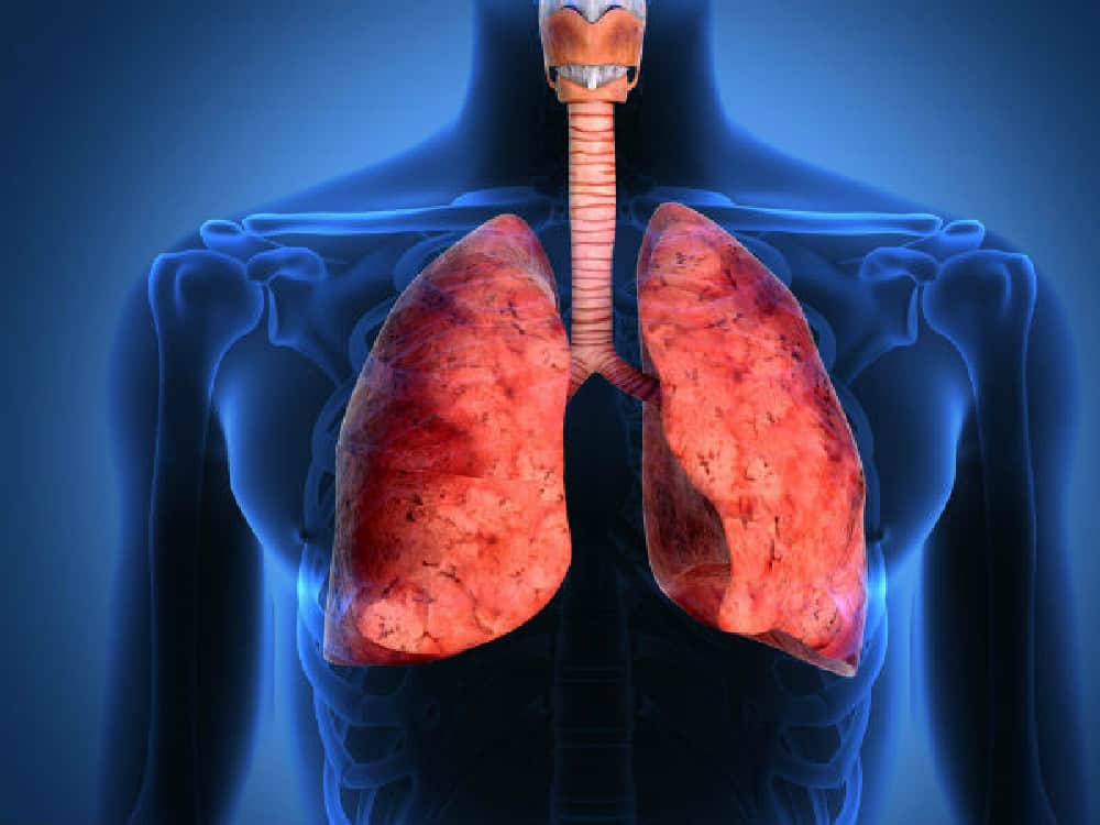 Kondisi paru penyebab batuk berdarah