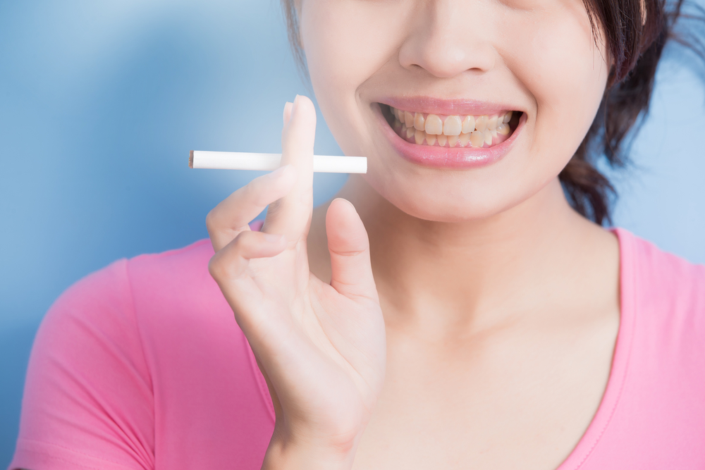 Kondisi Gigi Perokok dan Cara Menjaganya agar Sehat
