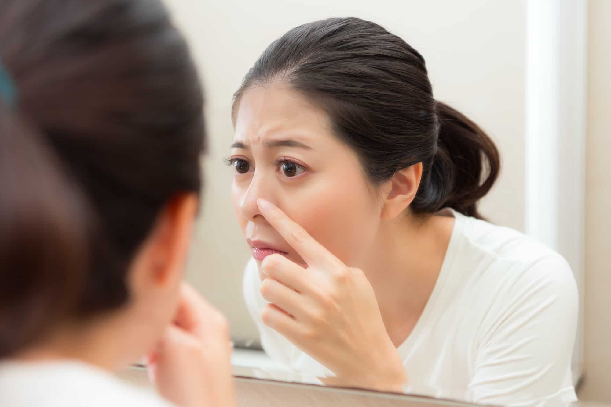 Penyebab dan Cara Mudah Mengatasi Jerawat di Hidung yang Mengganggu