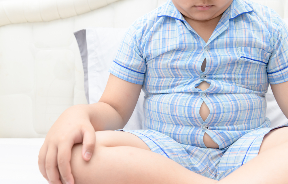 Bahaya Obesitas pada Anak yang Picu Penyakit Kronis saat Dewasa