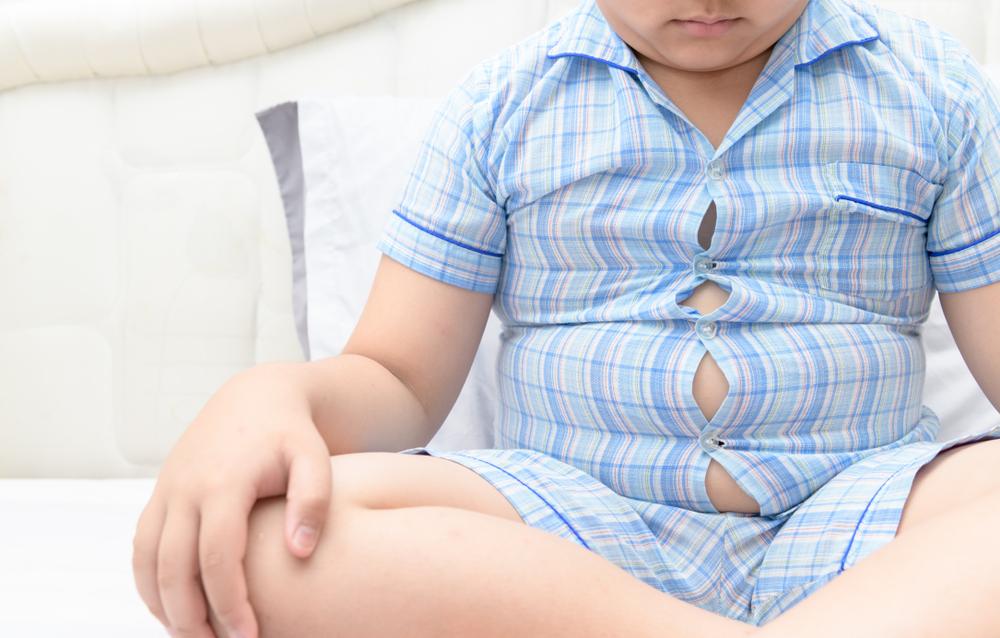 Bahaya Obesitas pada Anak yang Picu Penyakit Kronis saat Dewasa