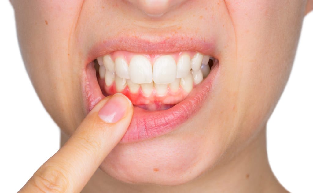 cara menghilangkan bau mulut saat puasa