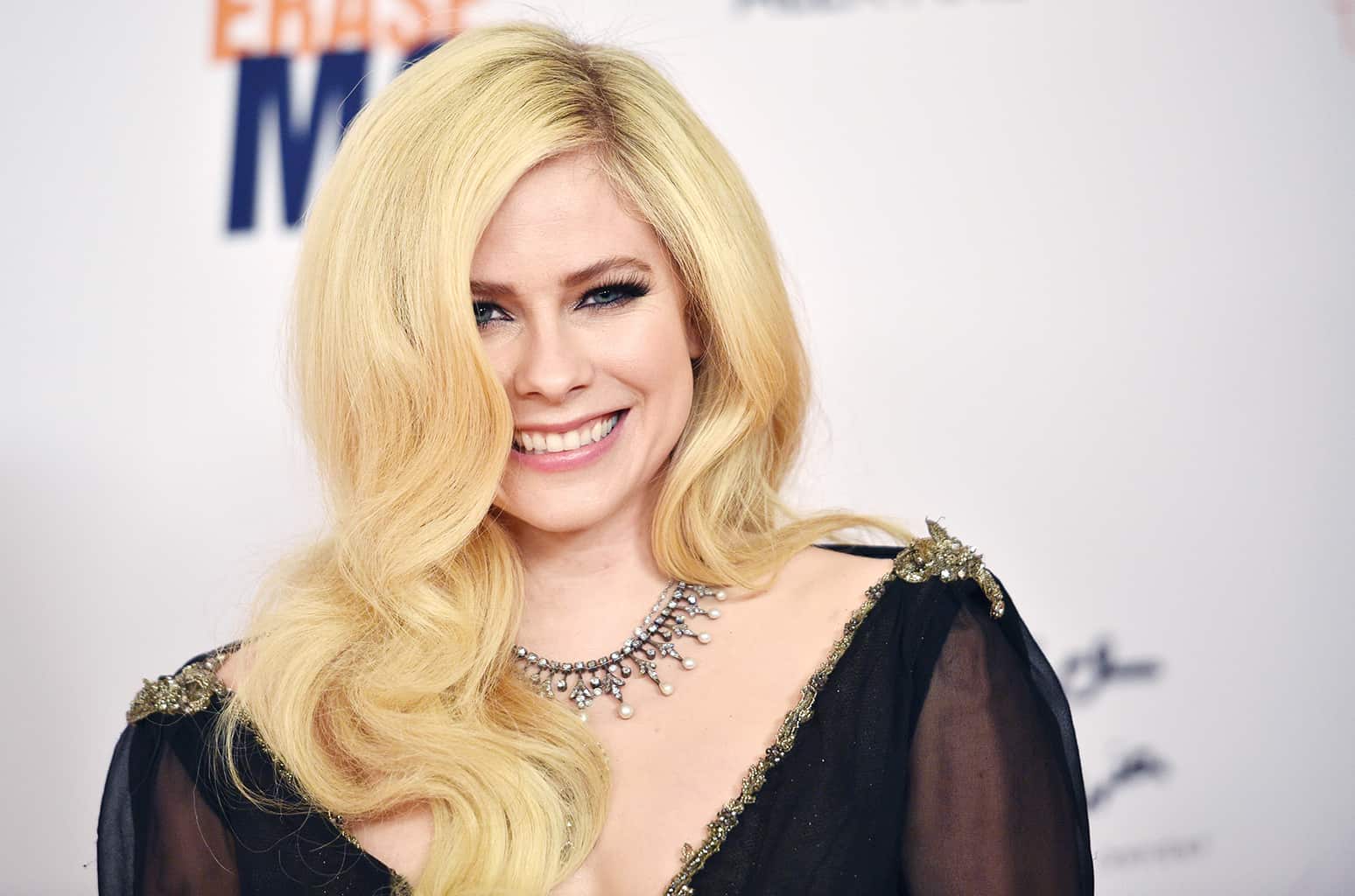Mengungkap Lyme Disease, Penyakit yang Mengubah Hidup Avril Lavigne