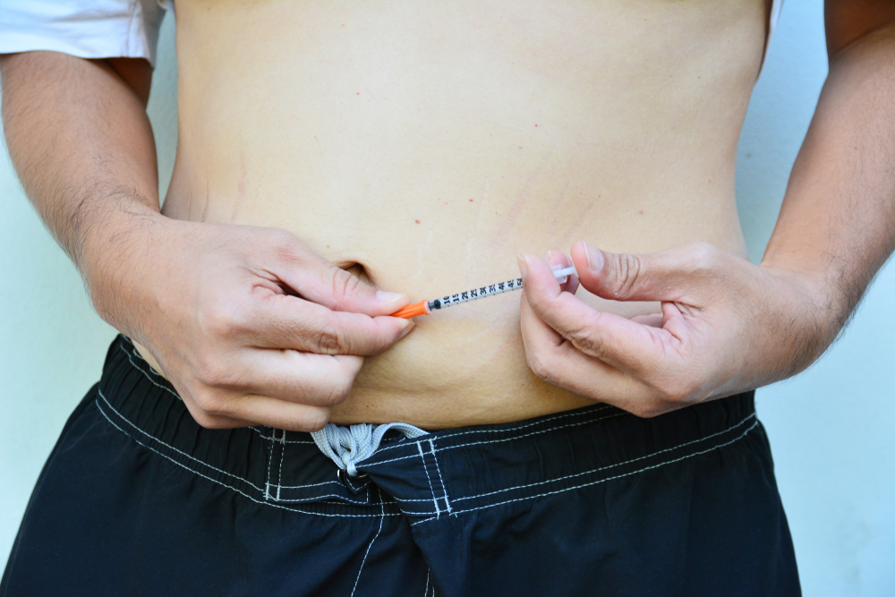Catat, Ini 4 Kesalahan Cara Suntik Insulin yang Sebaiknya Dihindari