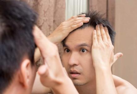 7 Cara Ampuh Menghilangkan Keriput pada Wajah Pria