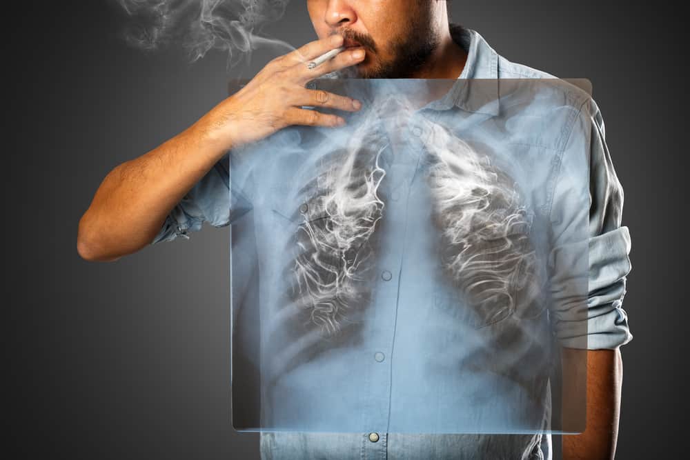6 Bagian Tubuh yang Paling Cepat Rusak Akibat Merokok