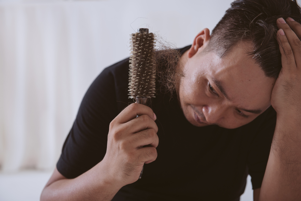 Obat Penumbuh Rambut agar Lebat dan Kurangi Kebotakan