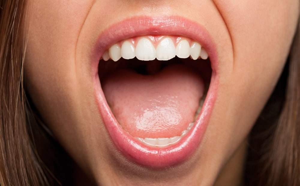 Agar Tidak Keliru, Kenali Gejala Psoriasis Mulut yang Kerap Dikira Sariawan Biasa