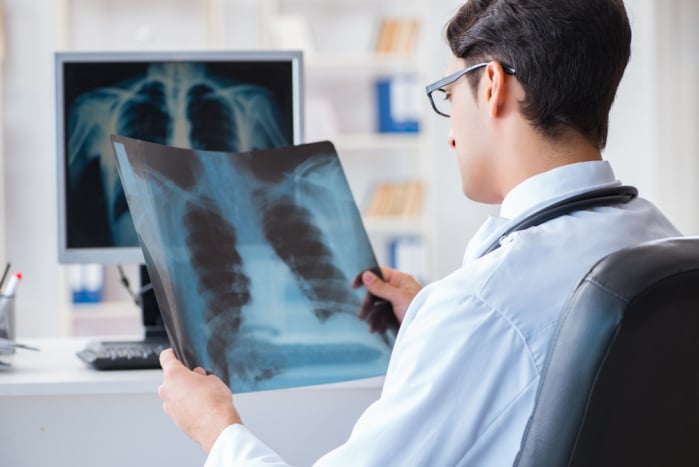 pengobatan kanker paru