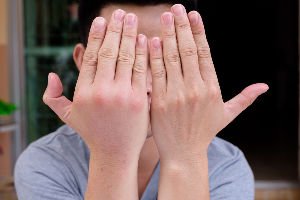 5 Penyebab Mengapa Tangan Tiba-tiba Membengkak di Pagi Hari