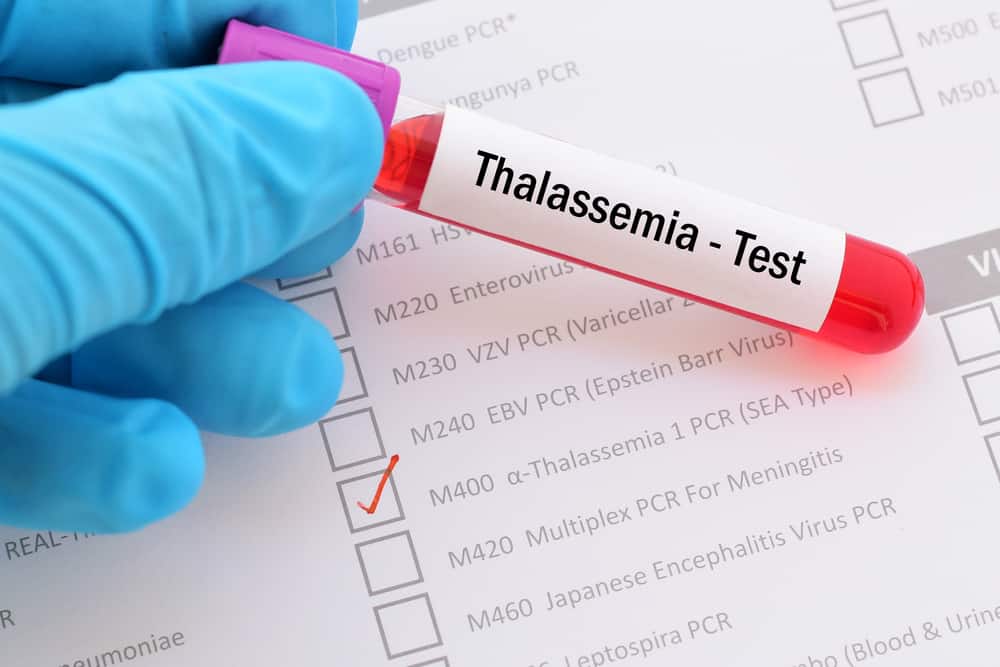 Talasemia penyakit Penyakit Thalasemia
