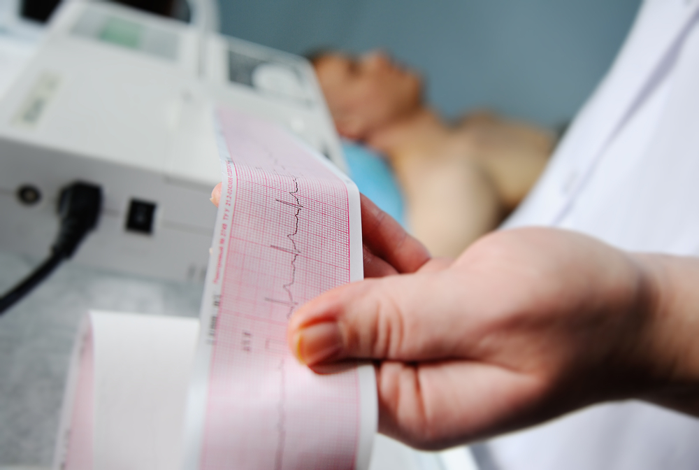 Elektrokardiogram/Elektrokardiografi (EKG)