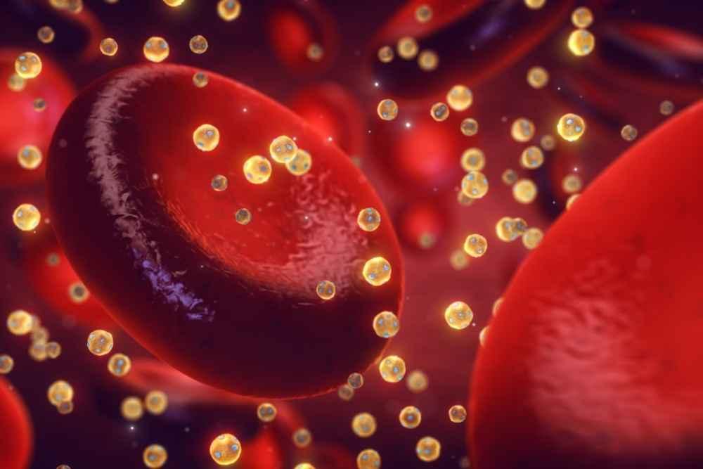 dislipidemia