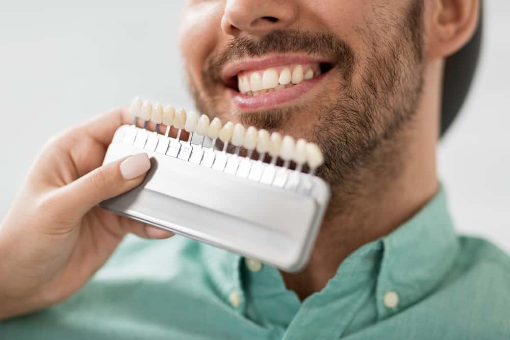 Kondisi Gigi yang Bisa Di-veneer dan Tidak Menurut Ahli
