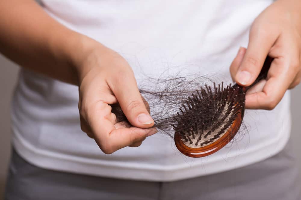 Hati-hati Botak, Rambut Pengidap Lupus Bisa Rontok Parah