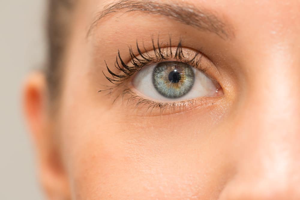 Penyebab Muncul Bercak Cokelat (Freckles) di Mata Plus Tandanya