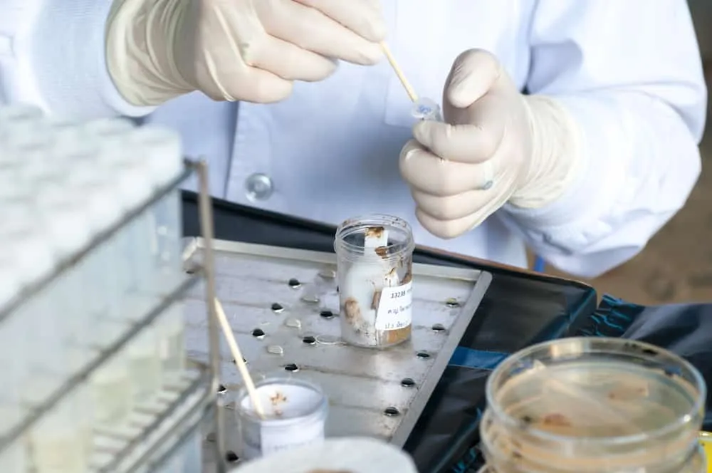 Kapan Anak Perlu Melakukan Pemeriksaan Feses?