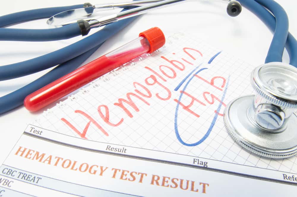 4 Penyebab Hemoglobin (Hb) Rendah, dari Anemia Hingga Kanker