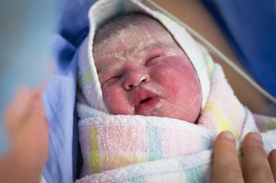 vernix caseosa pada bayi baru lahir