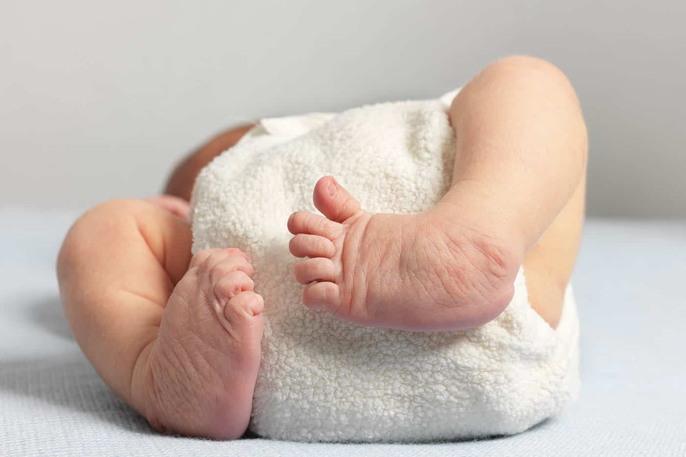 Bayi yang Lahir dengan Kaki Bengkok, Bisakah Disembuhkan?