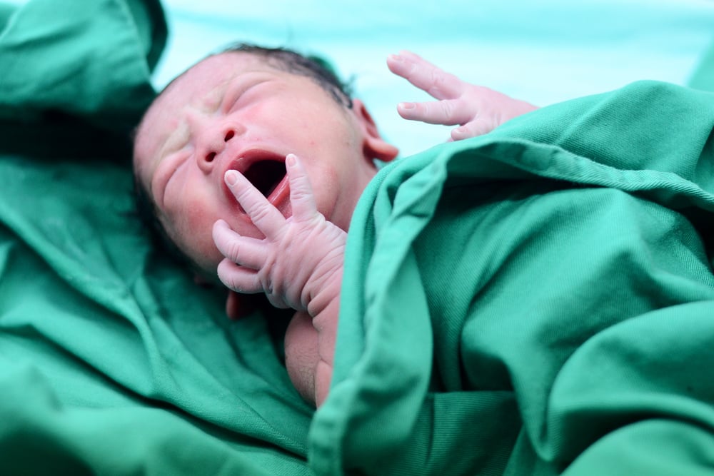 penyebab atresia ani pada bayi baru lahir