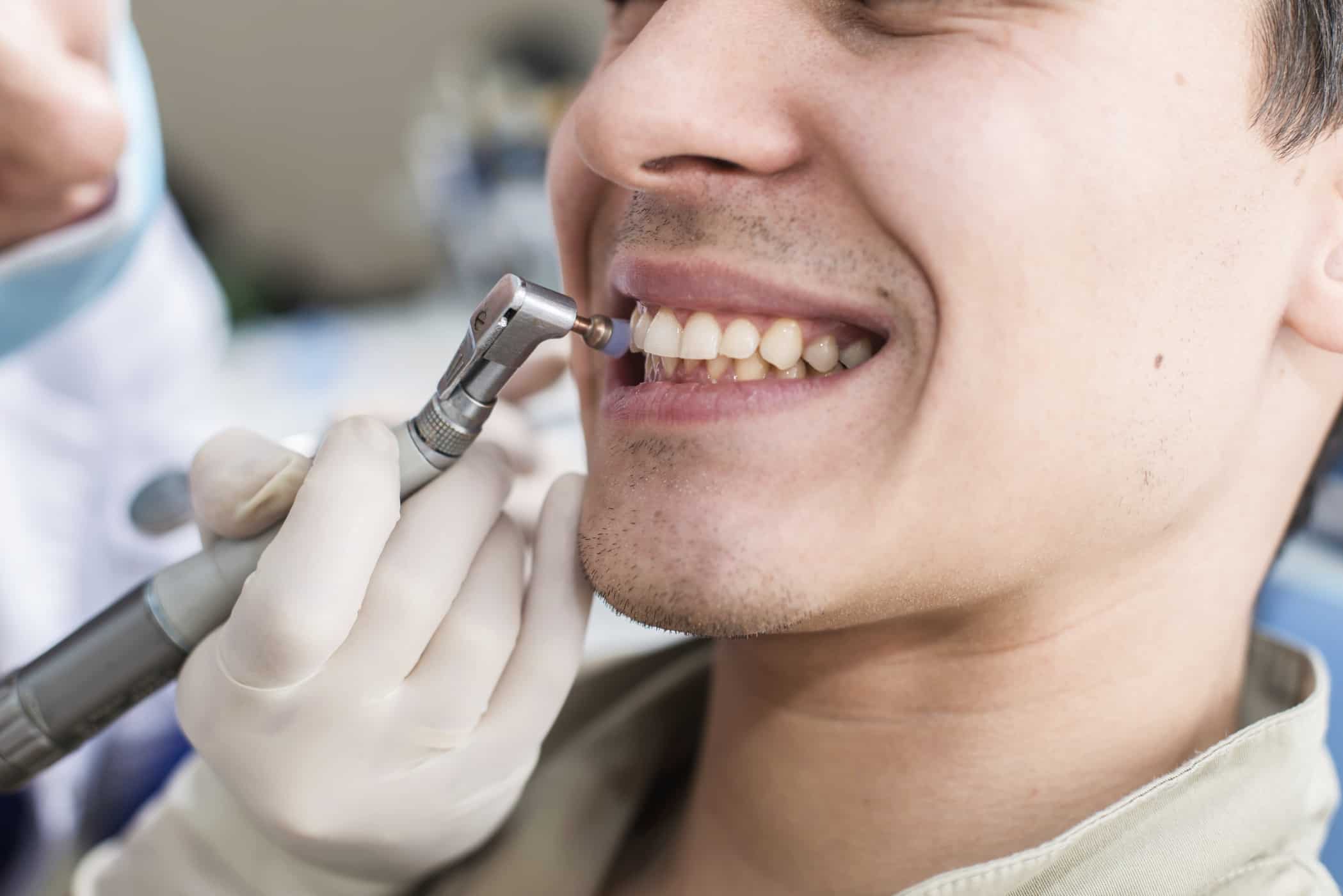 7 Cara Merapikan Gigi yang Bisa Anda Coba di Dokter Gigi