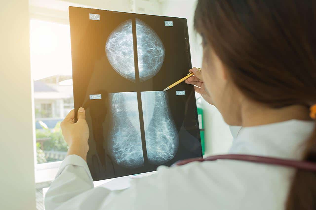 seberapa sering tes mamografi