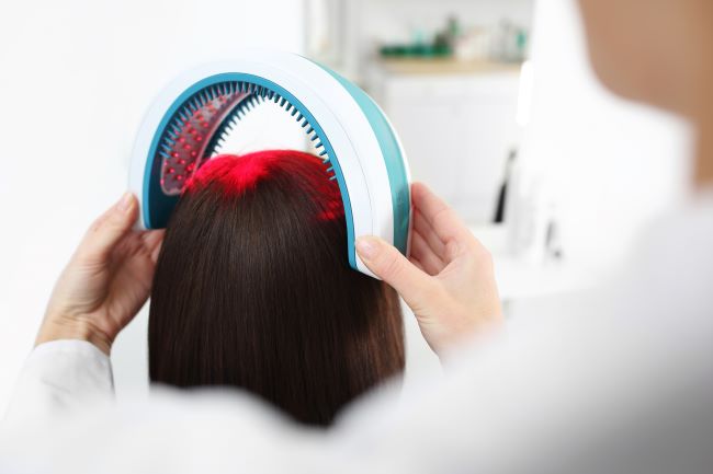 Apakah Terapi Laser Bermanfaat Menumbuhkan Rambut?