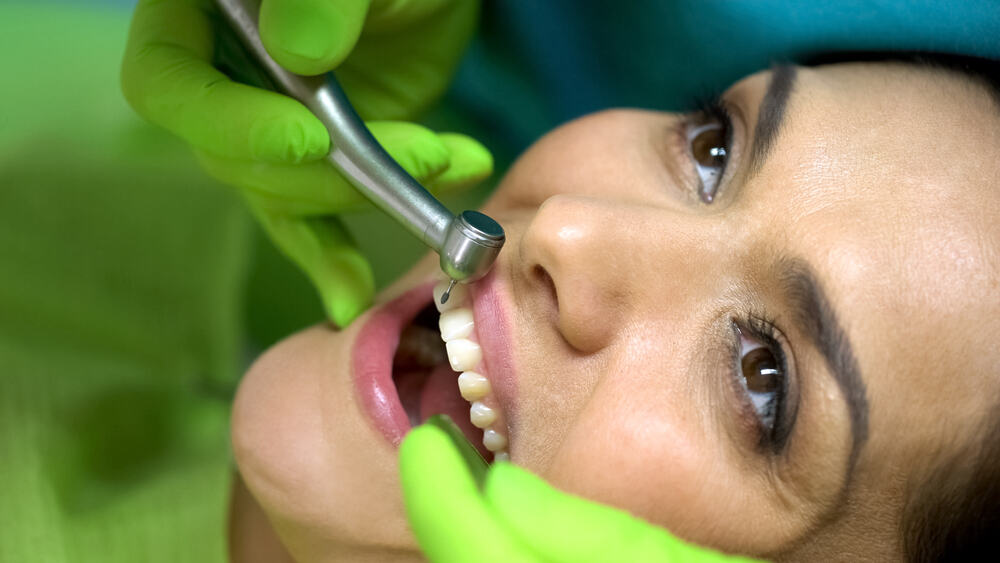 Mengenal Bonding Gigi, Solusi Ampuh Memperbaiki Tampilan Gigi yang Rusak