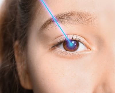 Operasi lasik mata pada anak