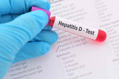 Tes diagnosis hepatitis D