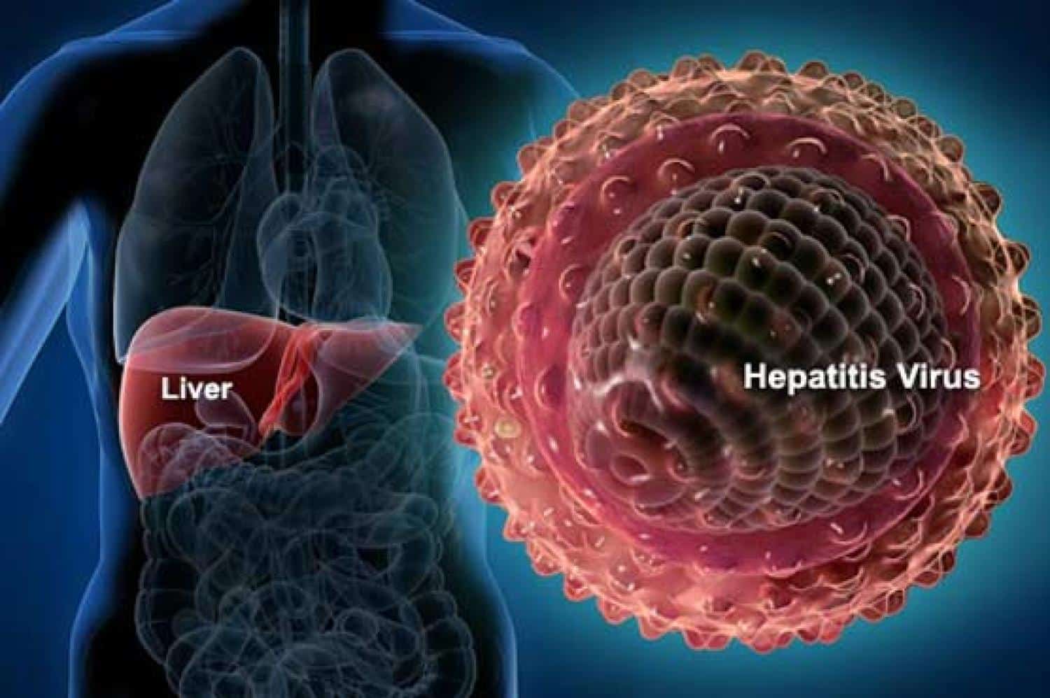 Jenis-Jenis Virus Hepatitis