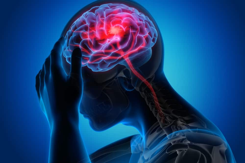 Efek obat stroke alami pada otak