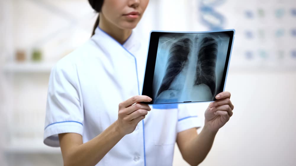 Berbagai Metode Pemeriksaan untuk Mendiagnosis TBC