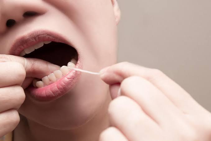Kapan Waktu yang Tepat Memakai Benang Gigi (Flossing)?