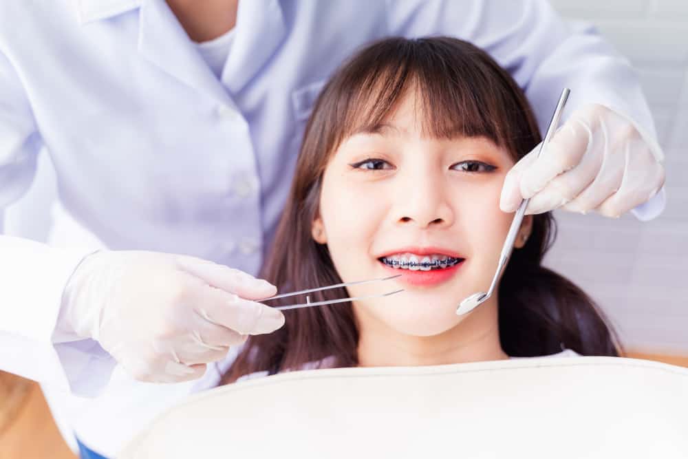 tips merawat gigi dengan behel