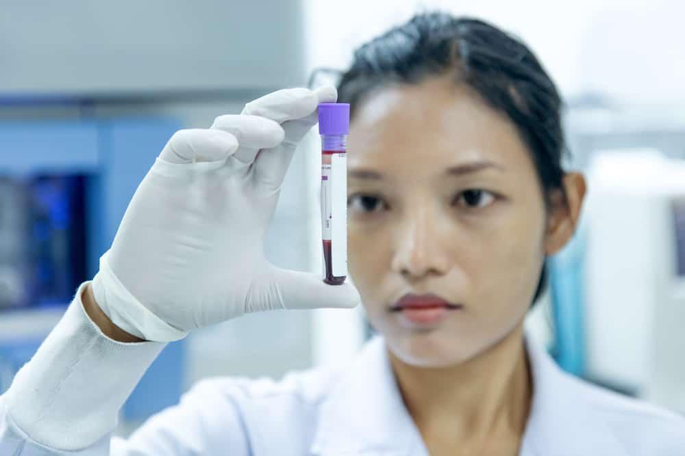 Hasil Tes Menunjukkan Kadar Limfosit Rendah, Apa Artinya?