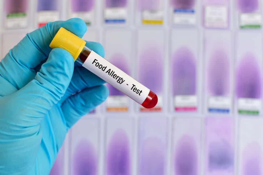 Berbagai Tes dan Pemeriksaan untuk Mendiagnosis Alergi Makanan