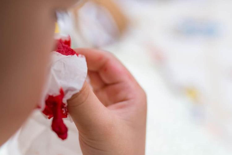 Hemofilia A: Gejala, Penyebab, dan Pengobatan | Hello Sehat
