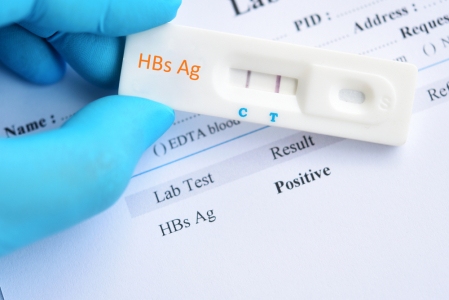 Tes HBsAg, Prosedur Diagnosis Penyakit Hepatitis B