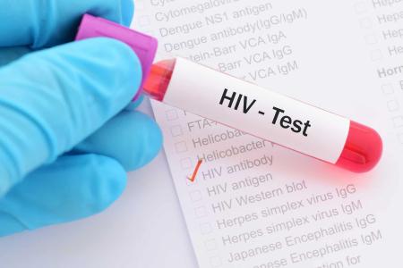 Mengenal 4 Jenis Tes HIV, Kapan Perlu Segera Tes?