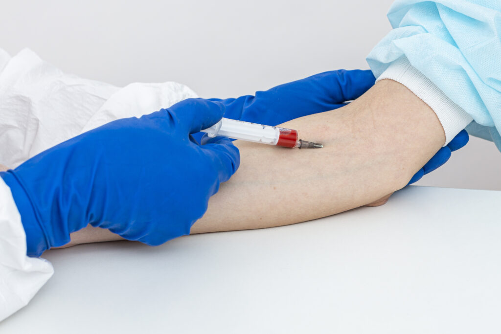 Proses pengambilan sampel tes darah