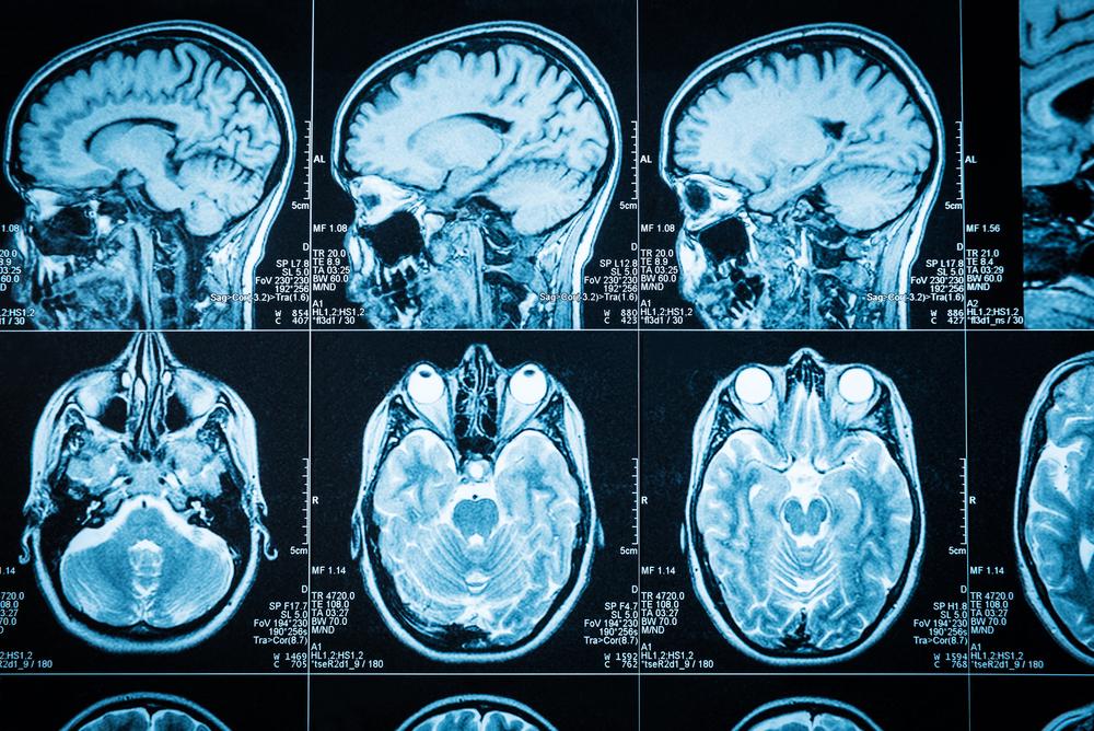 Ct Scan Kepala Prosedur Resiko Hasil Tes • Hello Sehat