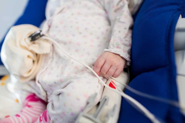Gastroschisis, Saat Bagian Dalam Perut Anak Ada di Luar Tubuh