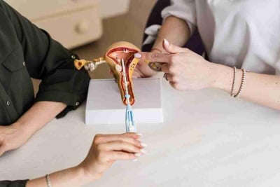 pemasangan iud
