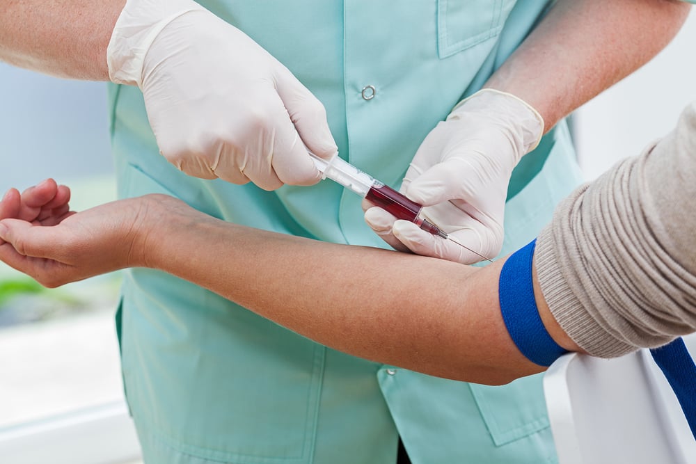 MCH, Komponen Pemeriksaan Sel Darah Merah yang Menggambarkan Penyakit